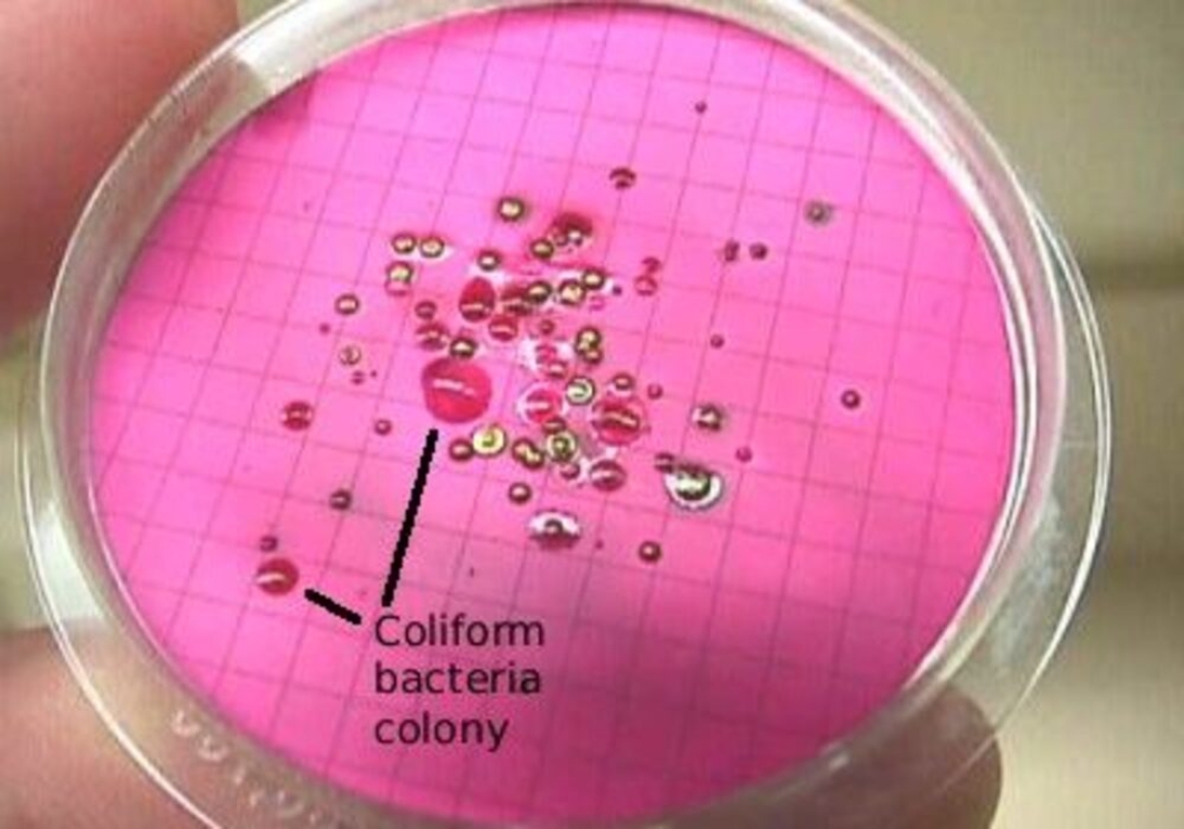 Fecal Coliform Bacteria In Water